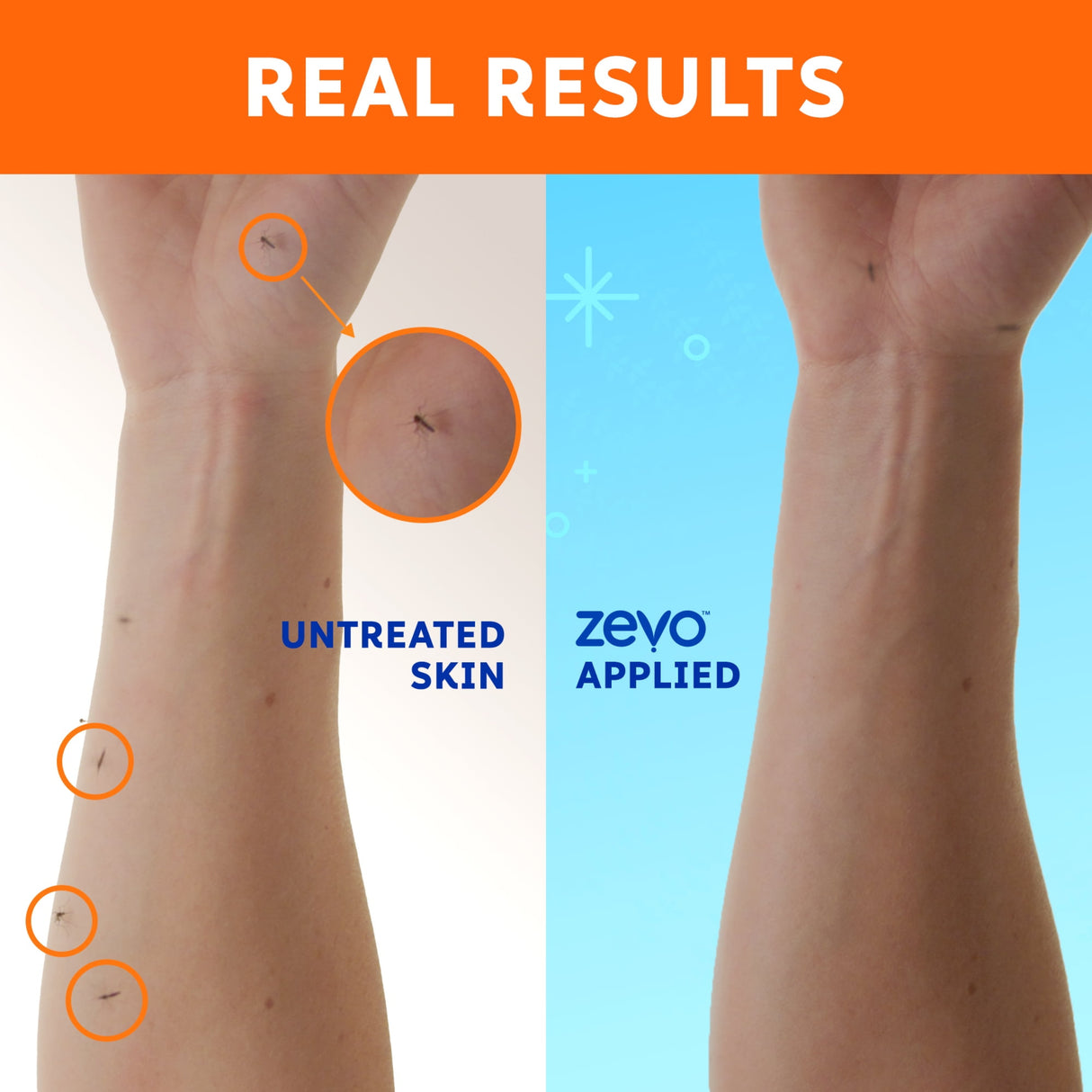 لوشن طارد البعوض والقراد على الجسم زيفو - 5.8 أونصة-3