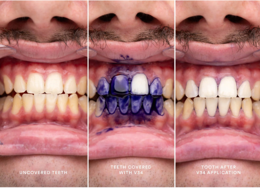 سيروم هايسميل في 34 لتصحيح اللون - 30 مل-4